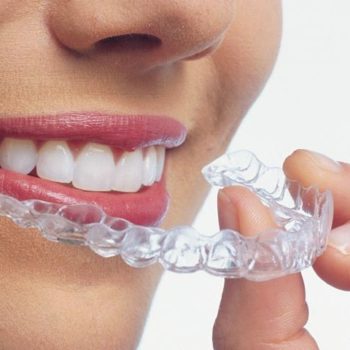 bite per gli sportivi