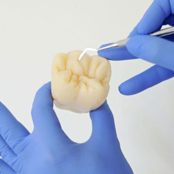 odontoiatria conservativa