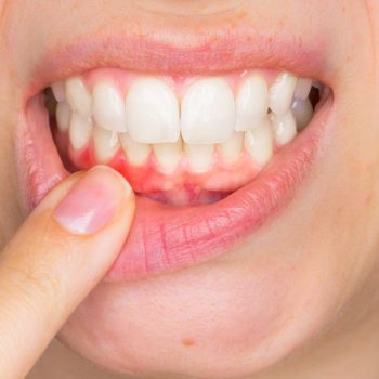 paradontologia studiopozzi